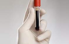 Недостоверные анализы – неправильный диагноз, который может «убить» человека!